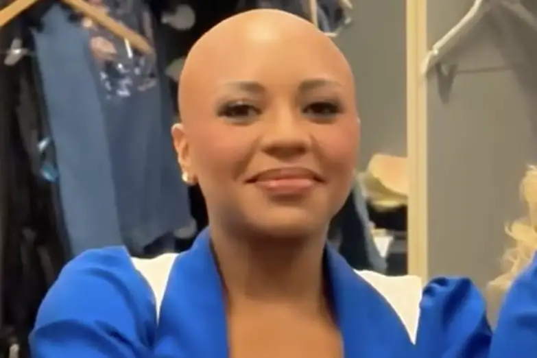 Dallas Cowboys Cheerleaders Star Armani Latimer Dances Without Wig for First Time Since Revealing Her Alopecia on Show. Armani Latimer. Photo: Dallas Cowboys Cheerleaders/Instagram