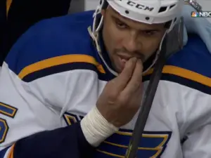 Ice hockey player pulls out his own tooth