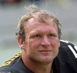 Mike Webster forehead