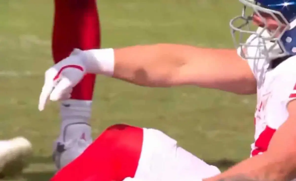 Eagles' Fans Actions As Cam Skattebo Is Carted Off After Snapping Leg In Half Goes Viral (Watch) 2 New York Giants' RB Cam Skattebo injured against the Philadelphia Eagles - Via NFL On FOX